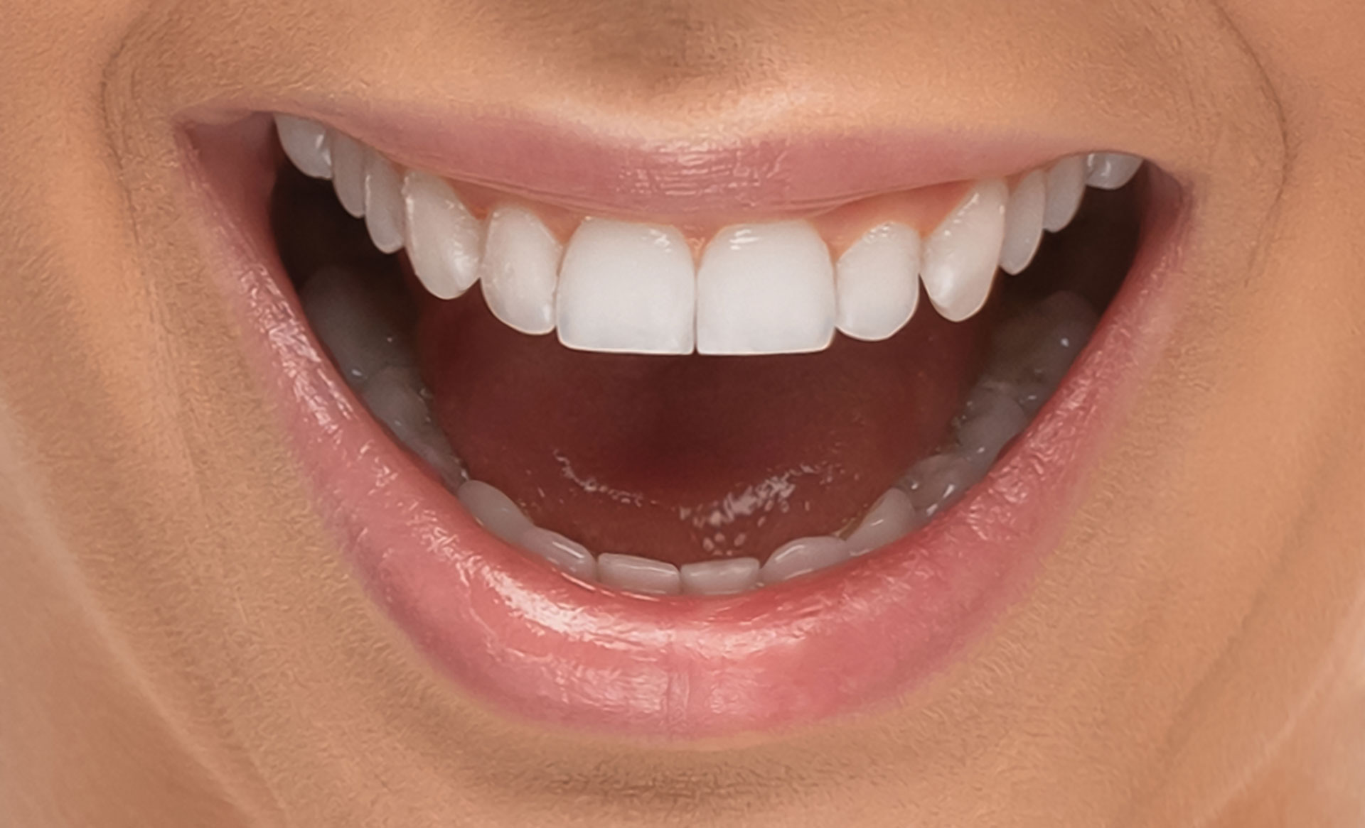 Close-up of a smiling mouth with clean, white teeth, highlighting good dental hygiene and fluoride treatment results